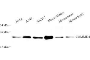 Western blot analysis of COMMD4 (ABIN7073559) at dilution of 1: 250 (COMMD4 anticorps)