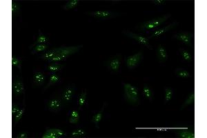 Immunofluorescence of purified MaxPab antibody to TSPYL6 on HeLa cell. (TSPY-Like 6 anticorps  (AA 1-410))
