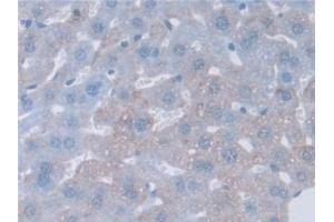 Detection of GAMT in Mouse Liver Tissue using Polyclonal Antibody to Guanidinoacetate-N-Methyltransferase (GAMT) (GAMT anticorps  (AA 2-236))