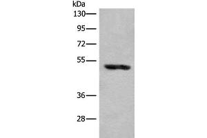Western blot analysis of Human placenta tissue lysate using KLHDC2 Polyclonal Antibody at dilution of 1:400 (KLHDC2 anticorps)