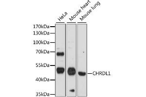 Western blot analysis of extracts of various cell lines, using CHRDL1 antibody (ABIN6292367) at 1:1000 dilution. (CHRDL1 anticorps)