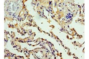 Immunohistochemistry of paraffin-embedded human lung tissue using ABIN7146811 at dilution of 1:100 (CEACAM8 anticorps  (AA 35-320))