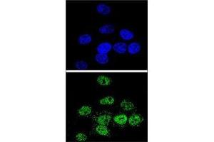 Confocal immunofluorescent analysis of MEF2A antibody with HeLa cells followed by Alexa Fluor 488-conjugated goat anti-rabbit lgG (green). (MEF2A anticorps  (AA 453-479))
