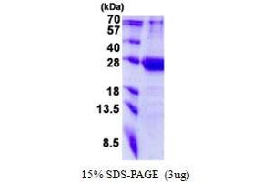 Image no. 1 for Mediator Complex Subunit 20 (MED20) protein (His tag) (ABIN1098486)