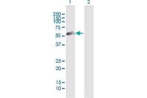 Western Blot analysis of ZNF232 expression in transfected 293T cell line by ZNF232 MaxPab polyclonal antibody. (ZNF232 anticorps  (AA 1-444))