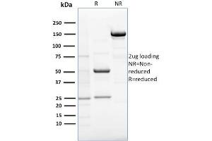 SDS-PAGE Analysis Purified RCAS1 Mouse Monoclonal Antibody (CPTC-EBAG9-1). (RCAS1 anticorps)