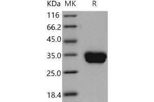 Western Blotting (WB) image for Carbonic Anhydrase IV (CA4) (Active) protein (His tag) (ABIN7194567)