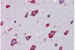 Brain, cortex, Human: Formalin-Fixed, Paraffin-Embedded (FFPE)