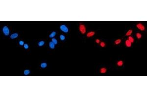 IF analysis of CBX1/HP1 beta using anti-CBX1/HP1 beta antibody (ABIN7602012).