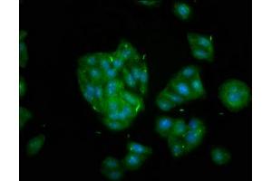 Immunofluorescence staining of HepG2 cells with ABIN7157616 at 1:133, counter-stained with DAPI. (KIF2B anticorps  (AA 1607-1731))