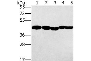 Western Blot analysis of Hela, skov3 and A549 cell, Mouse liver and Human ovarian cancer tissue using PON1 Polyclonal Antibody at dilution of 1:500 (PON1 anticorps)
