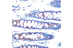 anti-Bone Morphogenetic Protein 4 (BMP4) antibody