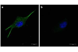 Immunofluorescence of α-tubulin using FITC-conjugated Fluorescent anti-mouse IgG Immunofluorescence microscopy of α-tubulin in U-87 MG cells using FITC-conjugated Fluorescent anti-mouse IgG  for detection. (Fluorescent TrueBlot®: Anti-Souris Ig Fluorescein)
