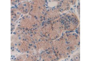 IHC-P analysis of Human Tissue, with DAB staining. (ERN1 anticorps  (AA 571-832))