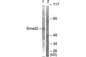 Western blot analysis of extracts from HepG2 cells, using Smad2 (Ab-467) Antibody.