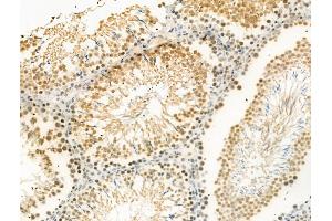 Phospho-Ki67 (Thr1335) Antibody at 1/100 staining Rat testis tissue by IHC-P. (Ki-67 anticorps  (pThr1335))