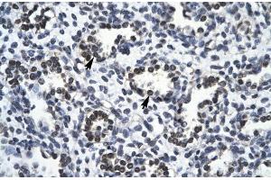 Rabbit Anti-RBM10 Antibody Catalog Number: ARP30103 Paraffin Embedded Tissue: Human Lung Cellular Data: Alveolar cells Antibody Concentration: 4.