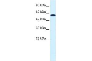 WB Suggested Anti-CHEK1 Antibody Titration:  0. (CHEK1 anticorps  (Middle Region))