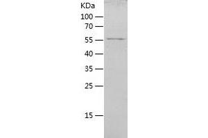 Western Blotting (WB) image for Interferon Induced with Helicase C Domain 1 (IFIH1) (AA 700-1025) protein (His-IF2DI Tag) (ABIN7123492)
