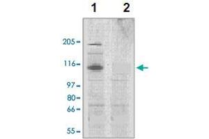 The tissue lysates derived from mouse heart (lane 1) or rat heart (lane 2) were immunoprobed by Corin polyclonal antibody  at 1 : 500. (Corin anticorps  (AA 300-450))