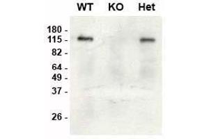 Immunoblot versus brain lysates from SAP97 wild-type (WT), knockout (KO) and heterozygous (Het) adult mice using K64/15 pure at 1 μg/mL (data courtesy of Lauren Makuch and Dr. (DLG1 anticorps  (N-Term))