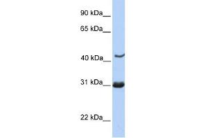 NUP35 antibody used at 1 ug/ml to detect target protein. (NUP35 anticorps  (C-Term))