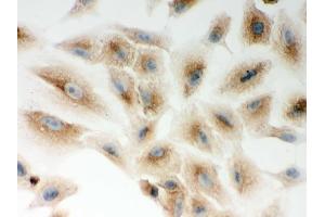 IHC analysis of CARD4  using anti-CARD4  antibody .