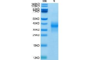 Biotinylated Human NKG2D on Tris-Bis PAGE under reduced condition. (KLRK1 Protein (His-Avi Tag,Biotin))
