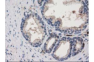 Image no. 3 for anti-ADP-Ribosylation Factor GTPase Activating Protein 1 (ARFGAP1) antibody (ABIN1496679) (ARFGAP1 anticorps)