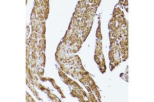 Immunohistochemistry of paraffin-embedded rat heart using VD Rabbit pAb (ABIN7271337) at dilution of 1:150 (40x lens). (VDAC2 anticorps  (AA 1-100))