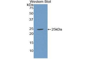 Western Blotting (WB) image for anti-Sex Hormone Binding Globulin (SHBG) (AA 224-388) antibody (ABIN1172834) (SHBG anticorps  (AA 224-388))