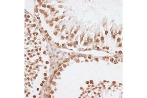 Immunohistochemistry of paraffin-embedded rat testis using Histone H2AX antibody (ABIN7267725) at dilution of 1:100 (40x lens). (Histone H2A anticorps  (C-Term))