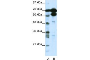 Western Blotting (WB) image for anti-Zinc Finger Protein 76 (Expressed in Testis) (ZNF76) antibody (ABIN2461696) (ZNF76 anticorps)