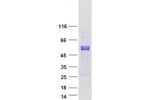 Validation with Western Blot