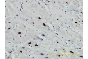 anti-Small Nuclear Ribonucleoprotein Polypeptide A (SNRPA) (AA 1-282) antibody