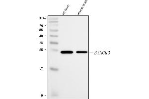 Western blot analysis of Synaptogyrin 3/SYNGR3 using anti-Synaptogyrin 3/SYNGR3 antibody (ABIN7601760). (Synaptogyrin 3 anticorps  (AA 45-229))