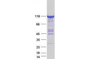 Validation with Western Blot