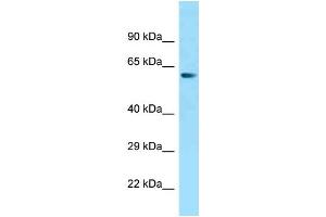 WB Suggested Anti-ZNF238 Antibody Titration: 1. (ZNF238 anticorps  (N-Term))