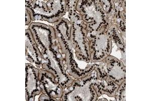 Immunohistochemical staining of human duodenum with ZFR polyclonal antibody  shows strong nuclear and membranous positivity in glandular cells at 1:10-1:20 dilution. (ZFR anticorps)