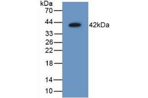 Figure. (AIMP1 anticorps  (AA 2-310))