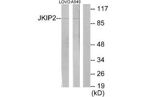 Western blot analysis of extracts from LOVO cells and A549 cells, using JKIP2 antibody. (JAKMIP2 anticorps  (C-Term))
