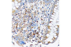 Immunohistochemistry of paraffin-embedded human appendix using CDC25B Rabbit mAb (ABIN7266250) at dilution of 1:100 (40x lens).