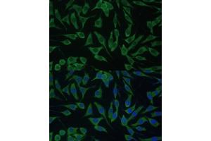 Immunofluorescence analysis of L929 cells using DDX3Y Polyclonal Antibody (ABIN6130260, ABIN6139496, ABIN6139497 and ABIN6215395) at dilution of 1:100 (40x lens).