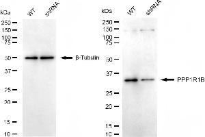 Western blotting analysis using PPP1R1B antibody (ABIN7800018). (Recombinant DARPP32 anticorps)