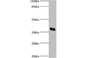 Western blot All lanes: Bile salt sulfotransferase antibody at 5 μg/mL + HepG2 whole cell lysate Secondary Goat polyclonal to rabbit IgG at 1/10000 dilution Predicted band size: 38 kDa Observed band size: 38 kDa