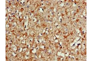 Immunohistochemistry of paraffin-embedded human brain tissue using  at dilution of 1:100 (ALK anticorps  (AA 1402-1604))