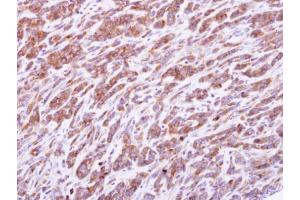 IHC-P Image PRPS1 antibody detects PRPS1 protein at cytosol on TOV-21G xenograft by immunohistochemical analysis.