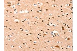 The image on the left is immunohistochemistry of paraffin-embedded Human brain tissue using ABIN7189955(BAZ1A Antibody) at dilution 1/25, on the right is treated with synthetic peptide. (BAZ1A anticorps)