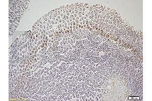 Formalin-fixed and paraffin embedded rat colon tissue labeled with Rabbit Anti-Leptin receptor(long) Polyclonal Antibody (ABIN725060) at 1:200 followed by conjugation to the secondary antibody and DAB staining.