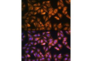 Immunofluorescence analysis of U2OS cells using SO Rabbit pAb (ABIN6129624, ABIN6148259, ABIN6148260 and ABIN6221917) at dilution of 1:100.